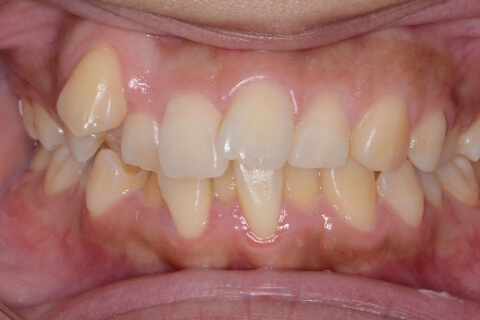 cases04