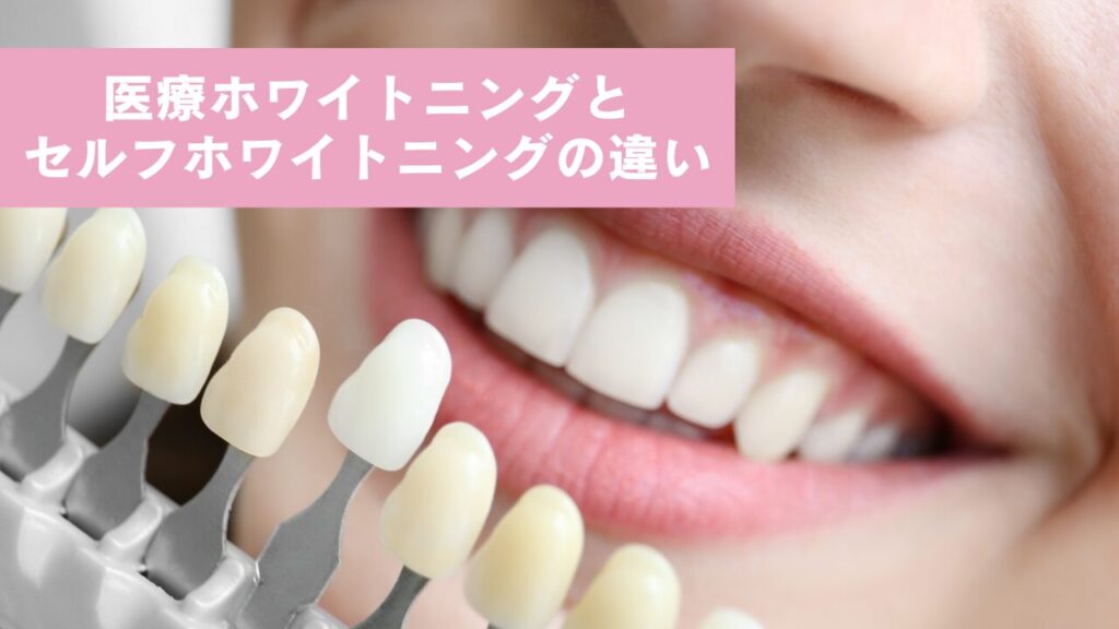 “医療ホワイトニングとセルフホワイトニングの違い”歯のシェードガイド(ホワイトニングの効果を確認できるトーンガイド)と歯を並べている様子。