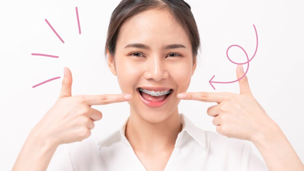 歯にブラケットをつけている矯正中の人。笑顔で自分の口元を指さしている様子。