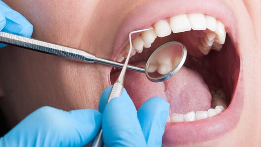 デンタルミラーと歯科器具を使用して口の中を見ている様子。