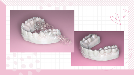 3Dプリンターで作られた模型とそこから作られたアライナー。