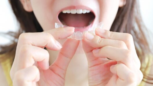 マウスピースを装着しようとしている女性の画像。