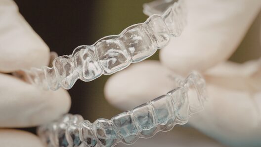 アライナーの画像。