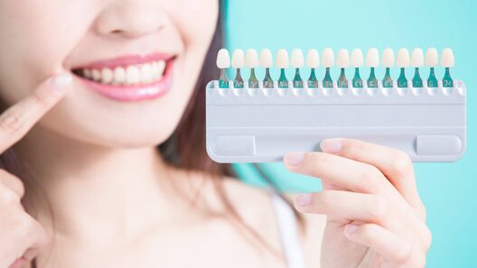 ホームホワイトニングの色調見本を持つ女性　歯の白さ比較のイメージ。